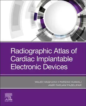 Radiographic Atlas of Cardiac Implantable Electronic Devices, Paperback/***