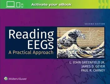 Reading EEGs: A Practical Approach, Paperback/James D. Geyer