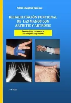 Rehabilitacin funcional de las manos con artritis y artrosis: Prevencin y tratamiento, Paperback/***