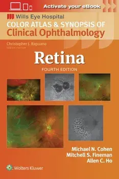 Retina. 4 ed, Paperback/Mitchell S. Fineman