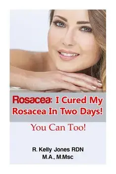 Rosacea: I Cured My Rosacea in Two Days! You Can Too!, Paperback/R. Kelly Jones