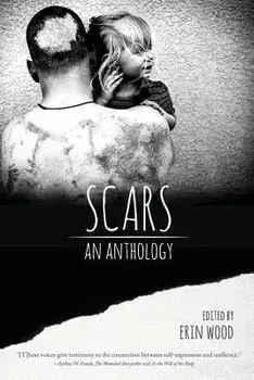 Scars: An Anthology, Paperback/Erin Wood