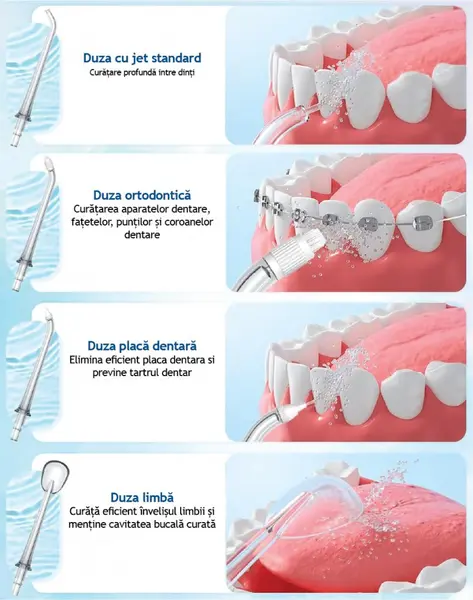 Set 4 duze interschimbabile pentru irigator bucal