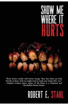 Show Me Where It Hurts - Robert E. Stahl