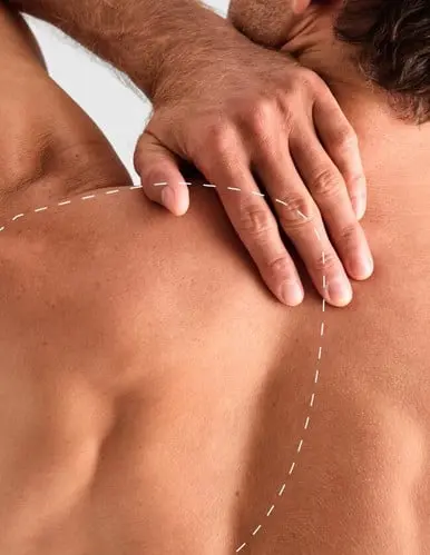 Spate 1/4 – Epilare Definitivă cu Laser - 1 Sedinte