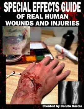 Special Effects Guide of Real Human Wounds and Injuries: Special Effects Guide of Real Human Wounds and Injuries, Paperback/Mr Benito Garcia III