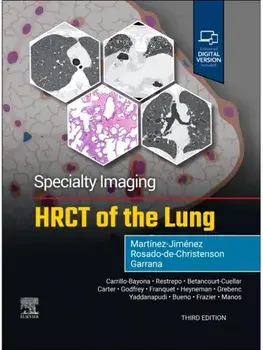 Specialty Imaging: HRCT of the Lung. 3 ed, Hardback/***