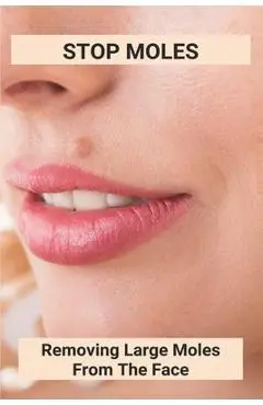 Stop Moles: Removing Large Moles From The Face: Surefire Way To Get Rid Of Moles - Shona Whitehouse