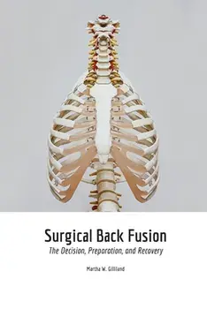 Surgical Back Fusion, Paperback/Martha Gilliland