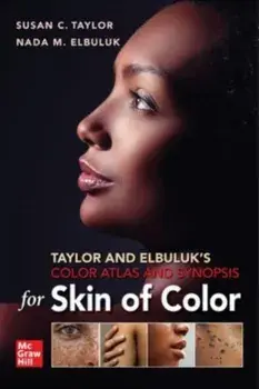 Taylor and Elbuluk's Color Atlas and Synopsis for Skin of Color, Paperback/Nada Elbuluk