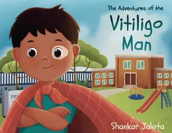 The Adventures of The Vitiligo Man, Paperback/Shankar Jalota