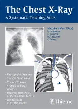 The Chest X-Ray. A Systematic Teaching Atlas, Paperback/Matthias Hofer