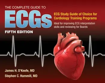 The Complete Guide to Ecgs: A Comprehensive Study Guide to Improve ECG Interpretation Skills, Paperback/James H. O'Keefe Jr