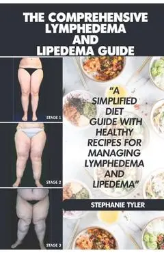 The Comprehensive Lymphedema and Lipedema Guide: The Comprehensive Lymphedema and Lipedema Guide - Stephanie Tyler
