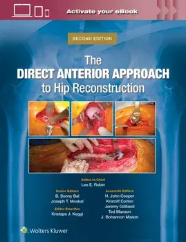 The Direct Anterior Approach to Hip Reconstruction. 2 ed, Hardback/Joseph T. Moskal