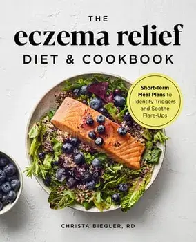 The Eczema Relief Diet & Cookbook: Short-Term Meal Plans to Identify Triggers and Soothe Flare-Ups, Paperback/Christa, Rd Biegler