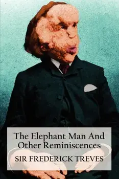 The Elephant Man and Other Reminiscences, Paperback/Frederick Treves