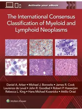 The International Consensus Classification of Myeloid and Lymphoid Neoplasms, Hardback/DANIEL A. ARBER