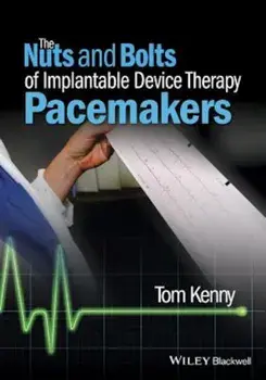 The Nuts and Bolts of Implantable Device Therapy: Pacemakers, Paperback/Tom Kenny