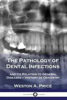 The Pathology of Dental Infections: and Its Relation to General Diseases - History of Dentistry, Paperback/Weston a. Price