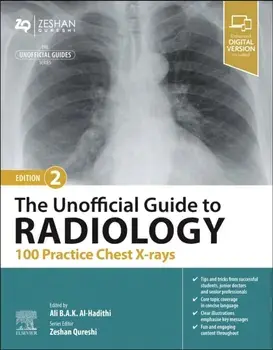 The Unofficial Guide to Radiology: 100 Practice Chest X-rays. 2 ed, Paperback/***
