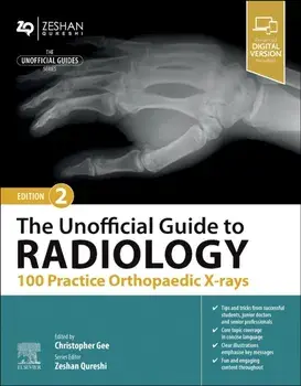 The Unofficial Guide to Radiology: 100 Practice Orthopaedic X-rays. 2 ed, Paperback/***