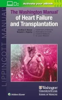 The Washington Manual of Heart Failure and Transplantation, Paperback/Benjamin Joseph Kopecky