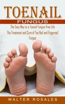 Toenail Fungus: The Easy Way to a Toenail Fungus-free Life (The Treatment and Cure of Toe Nail and Fingernail Fungus), Paperback/Walter Rosales