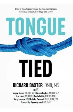 Tongue-Tied: How a Tiny String Under the Tongue Impacts Nursing, Speech, Feeding, and More - Dmd Richard Baxter