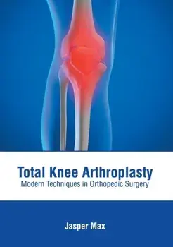 Total Knee Arthroplasty: Modern Techniques in Orthopedic Surgery, Hardcover/Jasper Max