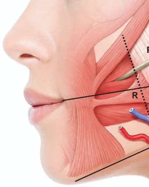 Tratament Bruxism - Default Title