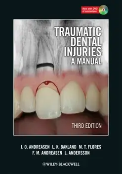 Traumatic Dental Injuries. A Manual, Paperback/Lars Andersson