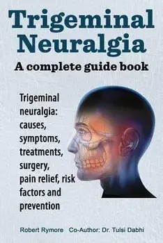 Trigeminal Neuralgia: A Complete Guide Book. Trigeminal Neuralgia: Causes, Symptoms, Treatments, Surgery,, Paperback/Robert Rymore