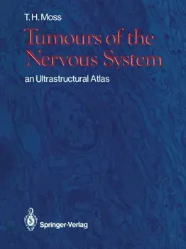 Tumours of the Nervous System. an Ultrastructural Atlas, Softcover reprint of the original 1st ed. 1986, Paperback/Timothy H. Moss
