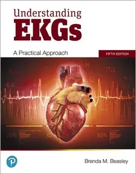 Understanding EKGs, Paperback/Brenda M. Beasley