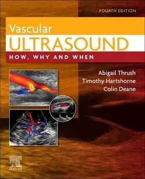 Vascular Ultrasound. How, Why and When, 4 ed, Hardback/***