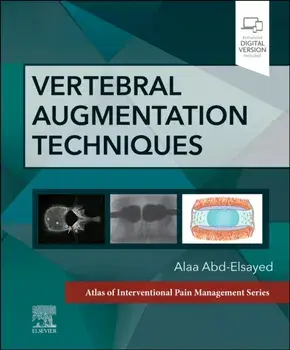 Vertebral Augmentation Techniques, Hardback/***