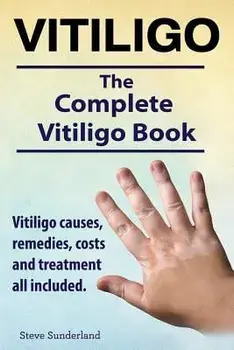 Vitiligo. Vitiligo Causes, Remedies, Costs and Treatment All Included. the Complete Vitiligo Book., Paperback/Steve Sunderland