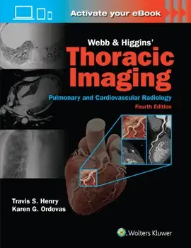 Webb & Higgins Thoracic Imaging: Print + eBook with Multimedia. 4 ed, Hardback/KAREN GOMES, MD, MAS ORDOVAS