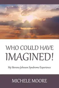 Who Could Have Imagined!: My Stevens-Johnson Syndrome Experience, Paperback/Michele Moore