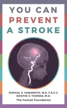 You Can Prevent a Stroke, Paperback/Joshua S. Yamamoto